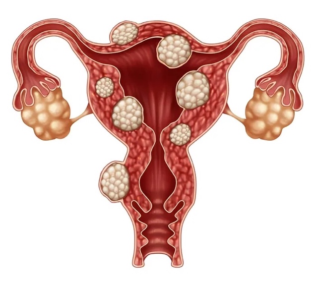 A diagram of a uterus

Description automatically generated
